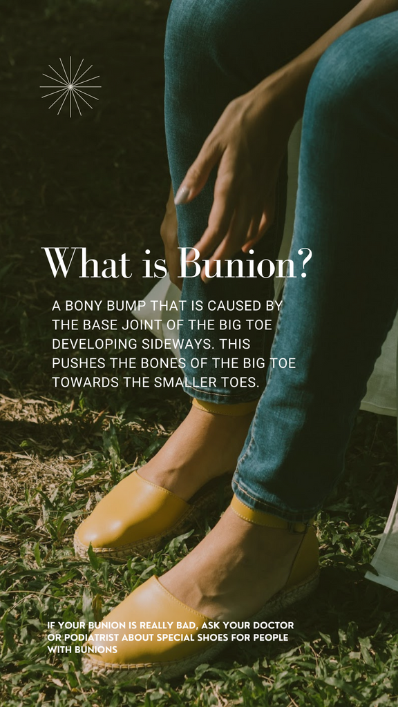 How to choose the right shoes when you have bunions.